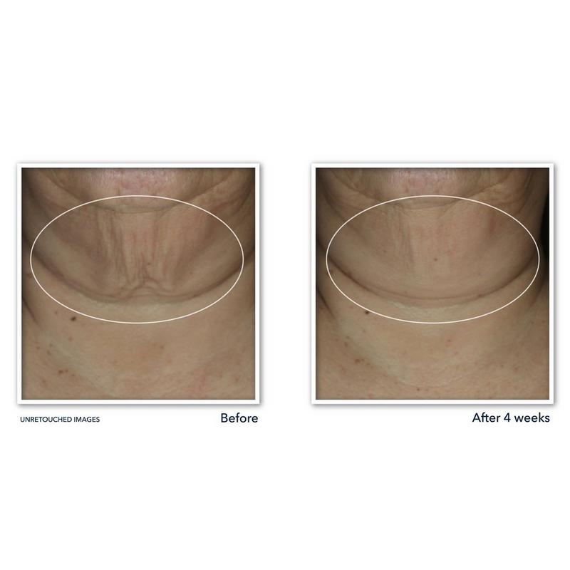 DERM CORREXION® Firming Serum Stick