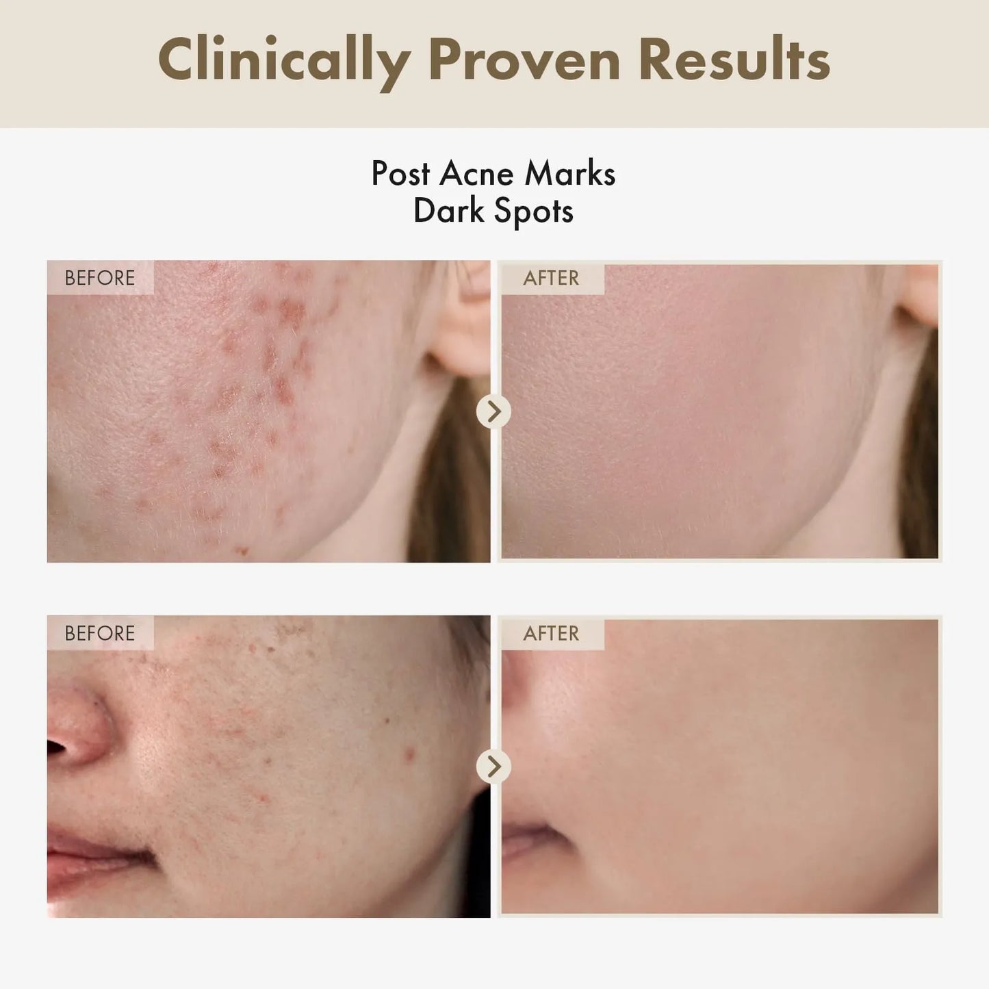 GlowRevive Cream : Arbutin 7% + Tranexamic Acid 4%