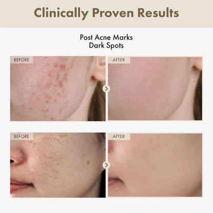 GlowRevive Cream : Arbutin 7% + Tranexamic Acid 4%